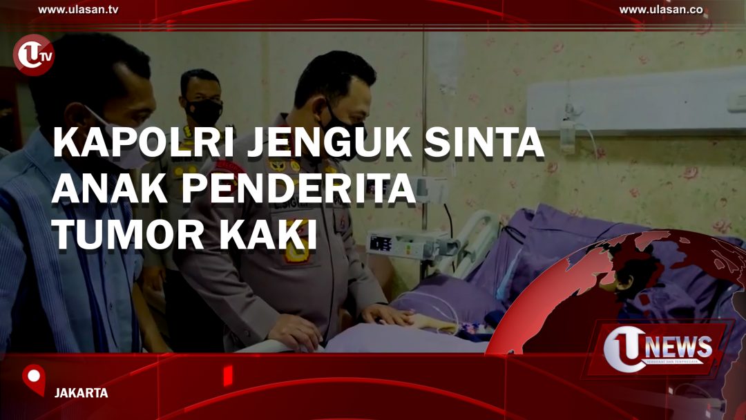 Kapolri Jenguk Sinta, Anak Penderita Tumor Kaki