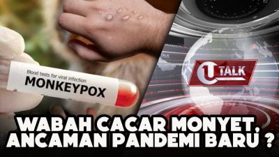 [LIVE] Waspada Ancaman Wabah Cacar Monyet ! | U-TALK