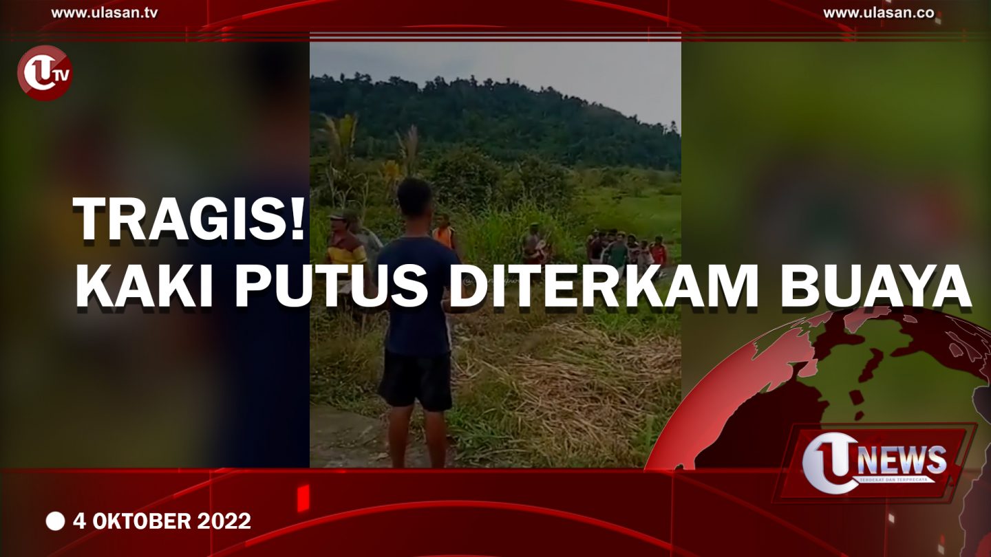 [Video] Warga Tidore Diterkam Buaya Hingga Kaki Putus