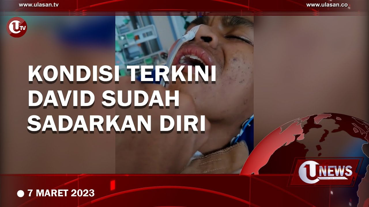 Tiga Pekan Koma, Kini David Ozora Telah Sadarkan Diri