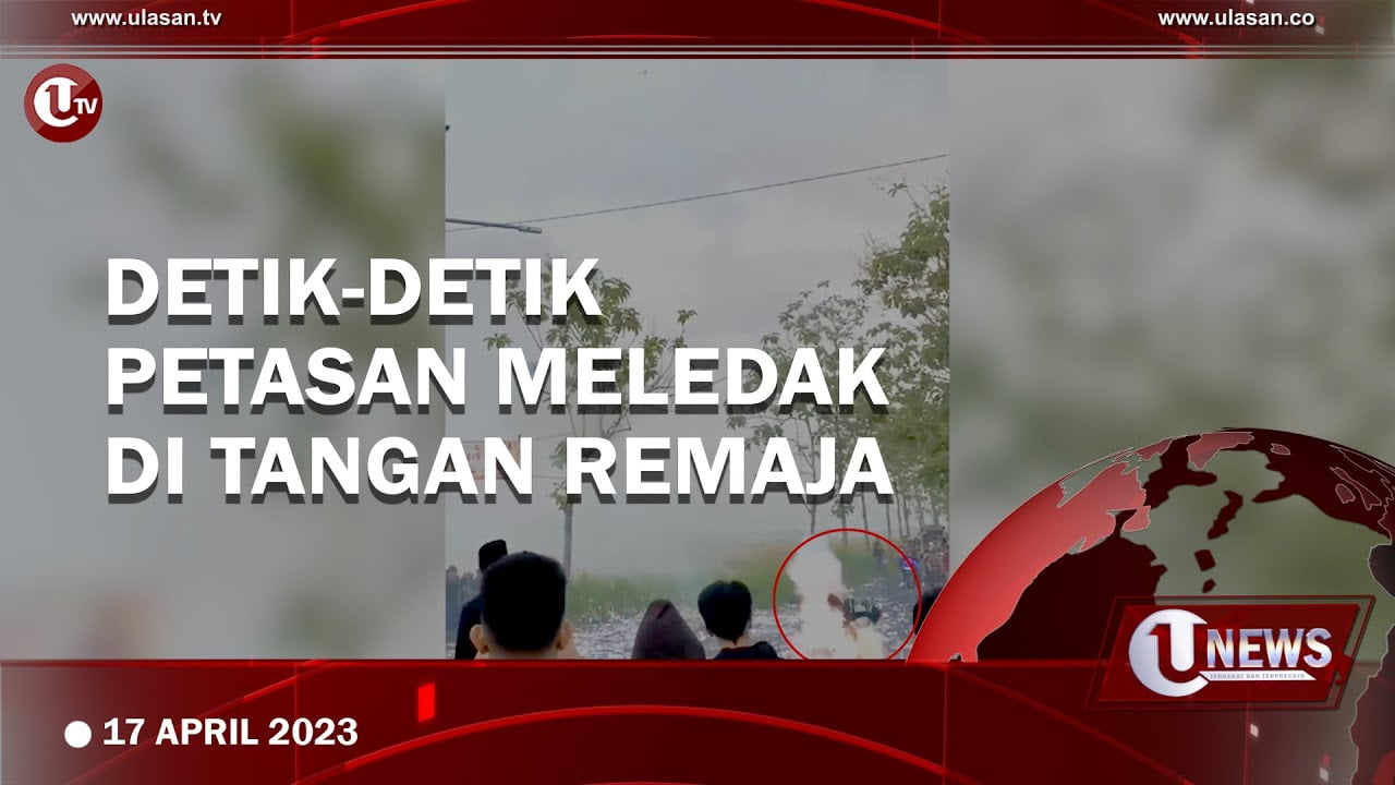 [Video] Petasan Meledak di Tangan, Remaja ini Alami Luka Serius di Tangan