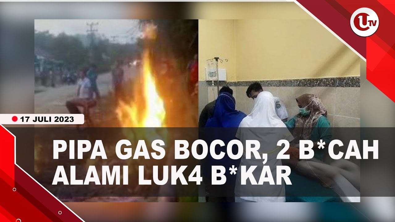 [Video] 2 Bocah SD Alami Luka Bakar Akibat Tersambar Api Pipa Gas Bocor | U-NEWS