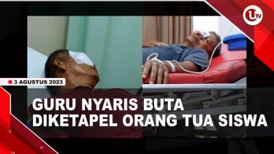 [Video] Guru SMA di Bengkulu Nyaris Buta Diketapel Orang Tua Siswa | U-NEWS
