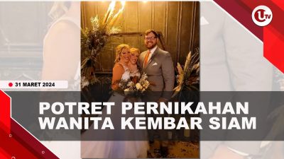 [Video] Wanita Kembar Siam Abby dan Brittany Menikah Dengan Veteran