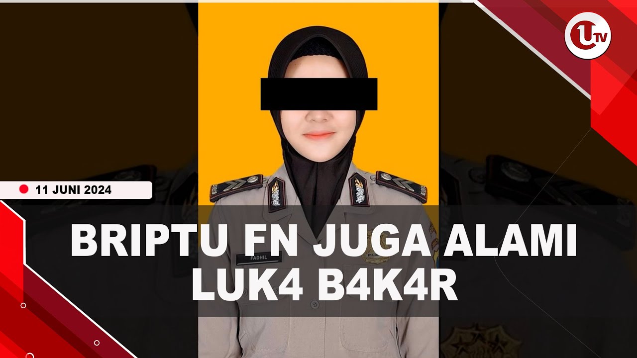 Polwan Bakar Suami Juga Alami Luka Bakar