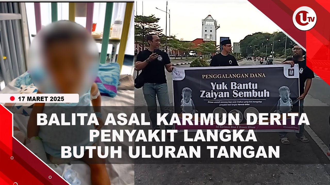 Penggalangan Dana untuk Balita Penderita Penyakit Hati Langka