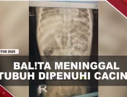 [VIDEO] Pilu, Balita 3 Tahun Meninggal Dengan Tubuh Dipenuhi Cacing | U-NEWS
