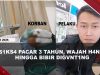 [VIDEO] Viral Wanita Dis!ks4 Pacar 3 Tahun, Wajah H4ncvr Hingga Bibir Hilang Digvnt!ng | U-NEWS