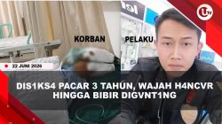 [VIDEO] Viral Wanita Dis!ks4 Pacar 3 Tahun, Wajah H4ncvr Hingga Bibir Hilang Digvnt!ng | U-NEWS